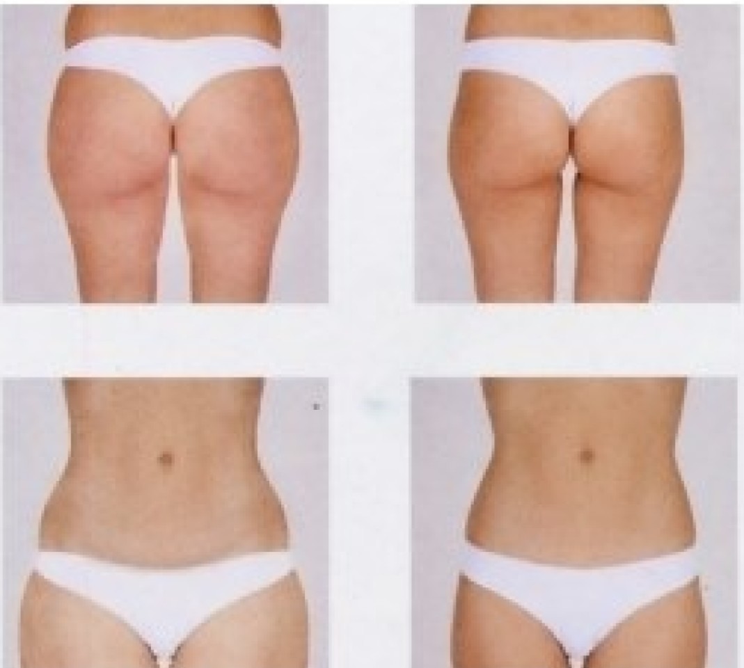 LE SOLEIL BEAUTY CENTERS S.R.L.